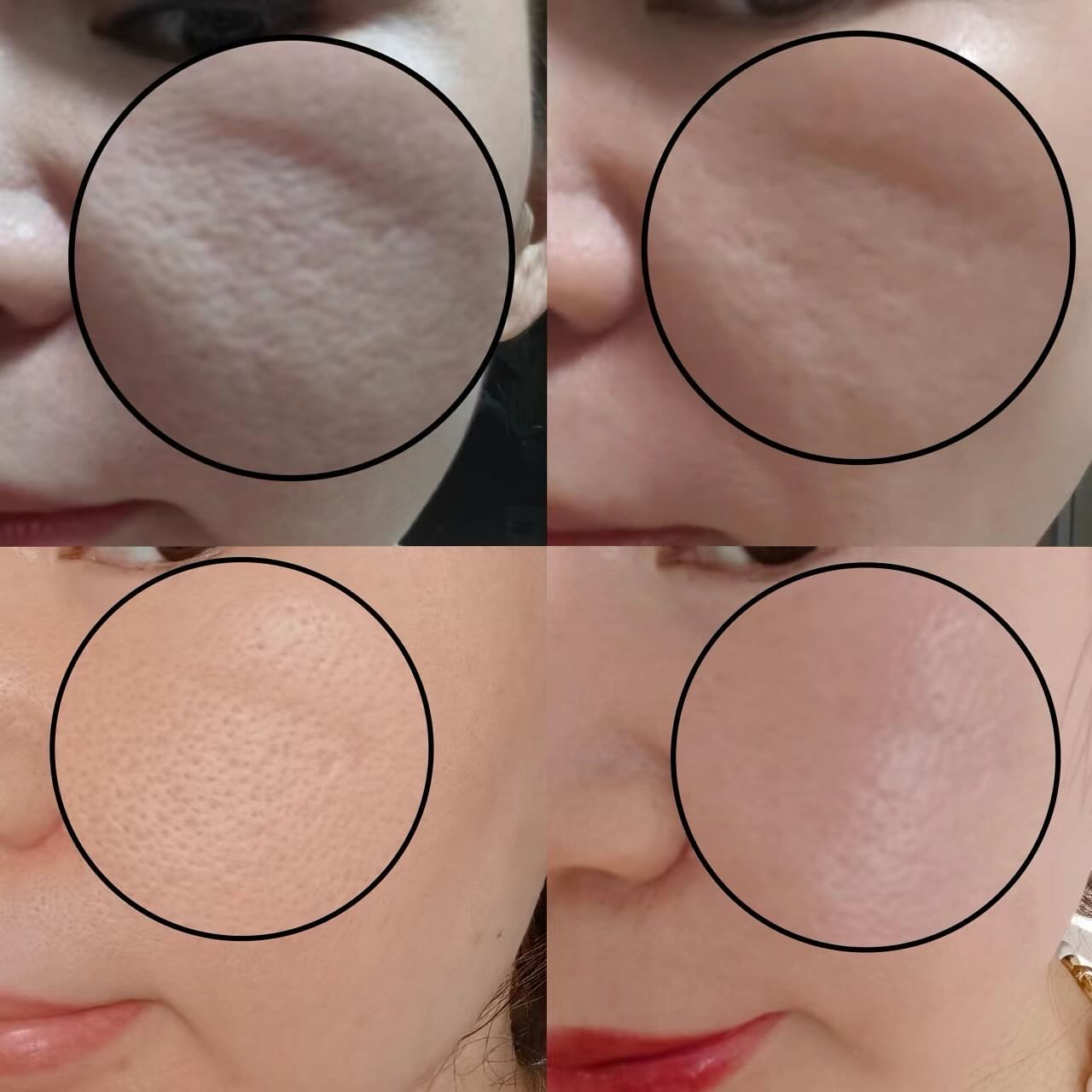 BEFORE/AFTER - rizzインターナショナルJAPAN